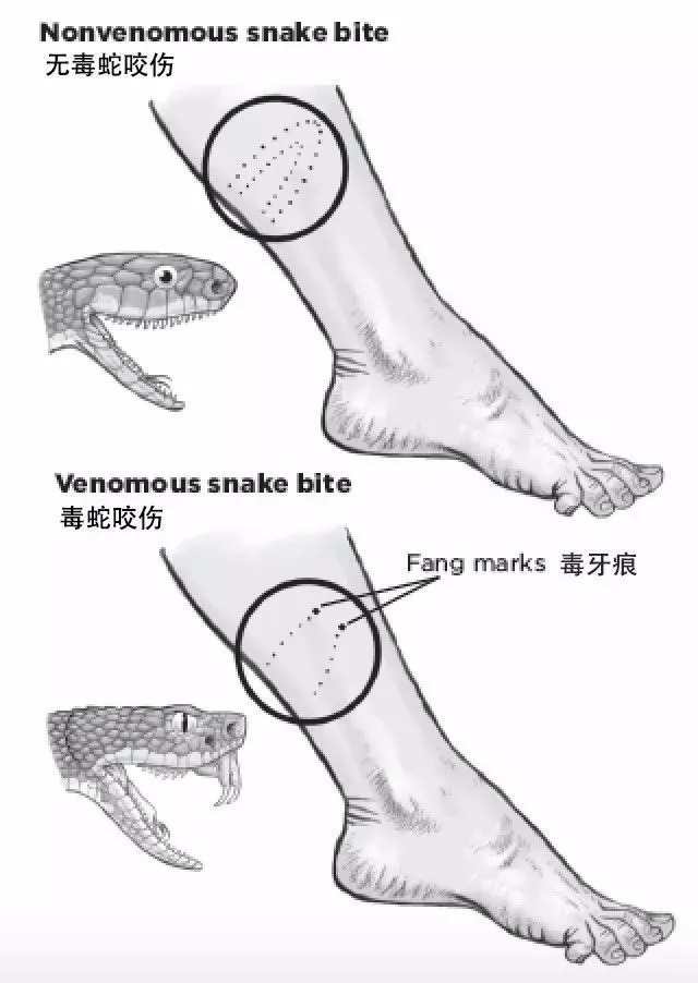 最新蛇咬人事件背后的感人故事揭秘